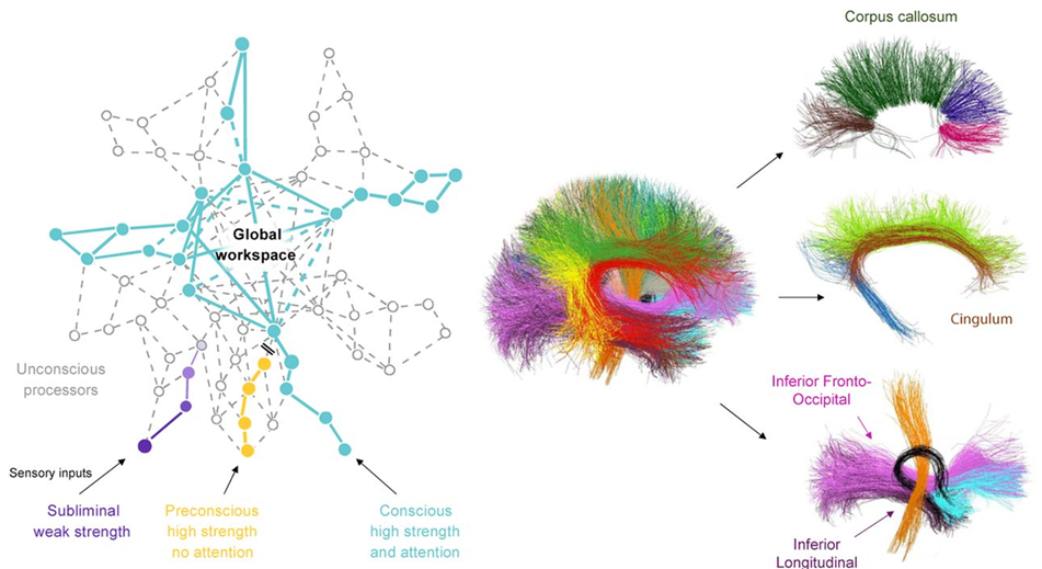 Prédictions de l'espace de travail neuronal global et vue détaillée des faisceaux d'intérêt. À gauche, la théorie de l'espace de travail neuronal global postule que l'information devient consciemment accessible lorsqu'elle est amplifiée par l'attention et déclenche une activité soutenue dans un vaste réseau de neurones interconnectés. La connectivité à longue distance des aires corticales supérieures, en particulier le cortex préfrontal, joue donc un rôle essentiel dans l'accès conscient. À droite, nous avons mené une analyse d'imagerie sur les faisceaux supposément impliqués dans l'espace de travail global. Les faisceaux fronto-occipitaux inférieurs (IFOF, en rose) et les faisceaux longitudinaux cingulaires (CLF, en marron) correspondent aux connexions postéro-antérieures à longue distance, ainsi que le corps calleux qui sous-tend la communication interhémisphérique et la formation d'un état d'ignition bihémisphérique unifié. Des faisceaux supplémentaires ont été inclus dans l'analyse comme sujets témoins (faisceaux longitudinaux inférieurs occipito-temporaux, ILF, en violet ; fibres courtes en U, non représentées sur cette figure) afin de vérifier si une corrélation entre le seuil de masquage et la connectivité cérébrale était spécifique aux fibres impliquées dans l'espace de travail neuronal global. (Berkovitch 2021)